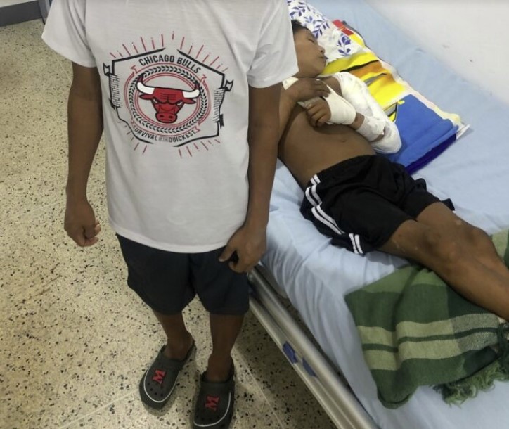 El menor de edad herido en Parima B durante los hechos del 20 de marzo
