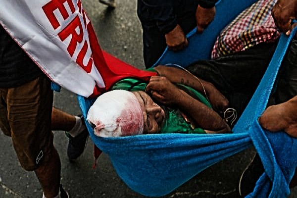 La represión de las fuerzas de seguridad contra las protestas de este jueves en Perú dejó más de una decena de personas heridas.

